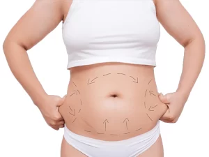 ابدومینوپلاستی