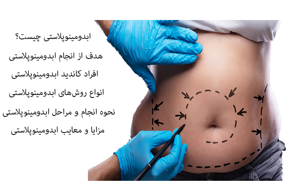 ابدومینوپلاستی چیست؟