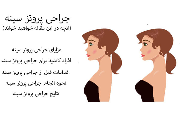 جراحی پروتز سینه