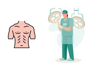 عمل ژنیکوماستی