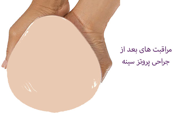 مراقبت های بعد از عمل پروتز سینه