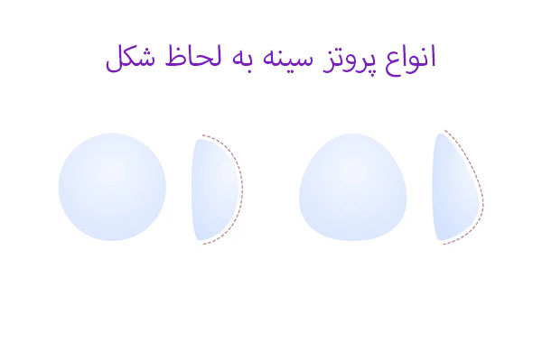 انواع پروتز سینه به لحاظ شکل