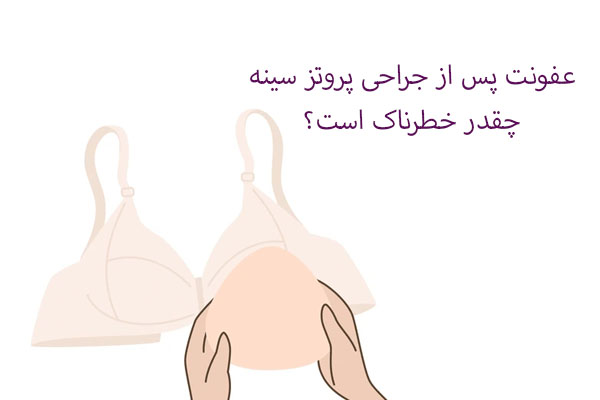 عفونت پس از جراحی پروتز سینه
