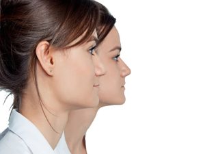 عمل بینی استخوانی