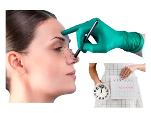 عمل بینی هنگام پریودی