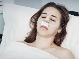 نحوه خوابیدن پس از عمل بینی