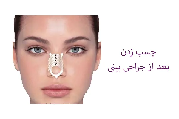 چسب زدن بعد از جراحی بینی