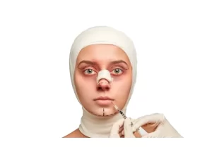 کبودی چشم بعد از رینوپلاستی