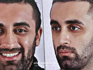 ویژگی‌های جراحی بینی فانتزی