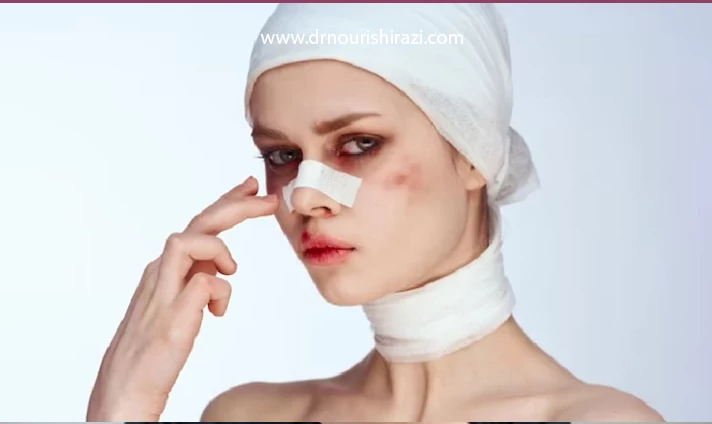 عمل بینی برای چه کسانی خطرناک است؟