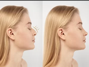 عمل بینی نیمه فانتزی گرگان