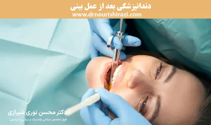 دندانپزشکی بعد از عمل بینی