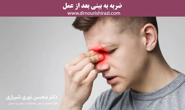 ضربه به بینی بعد از عمل