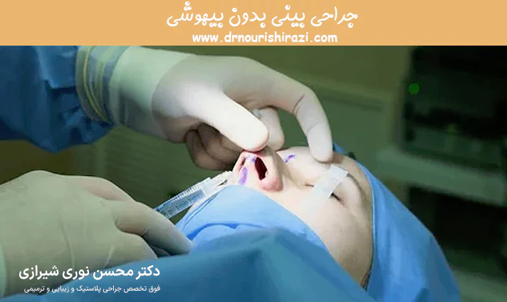 جراحی بینی بدون بیهوشی